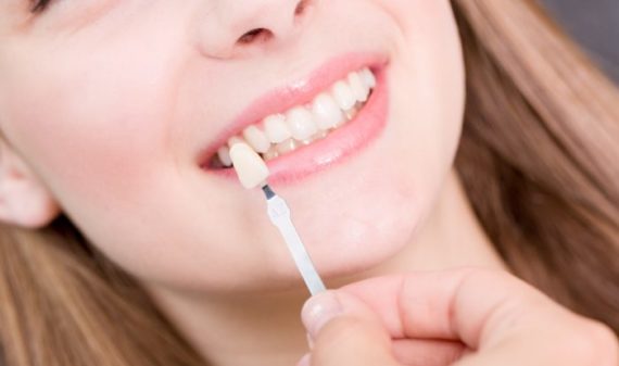Emergencia dental en Miami Brickel