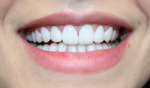 Enamel Care