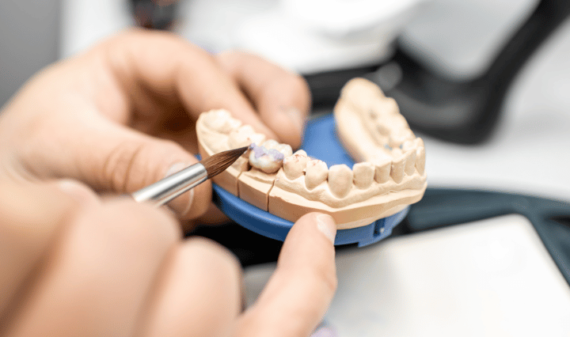 dental restoration methods