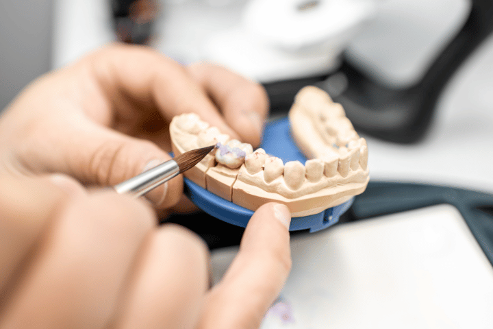 dental restoration methods