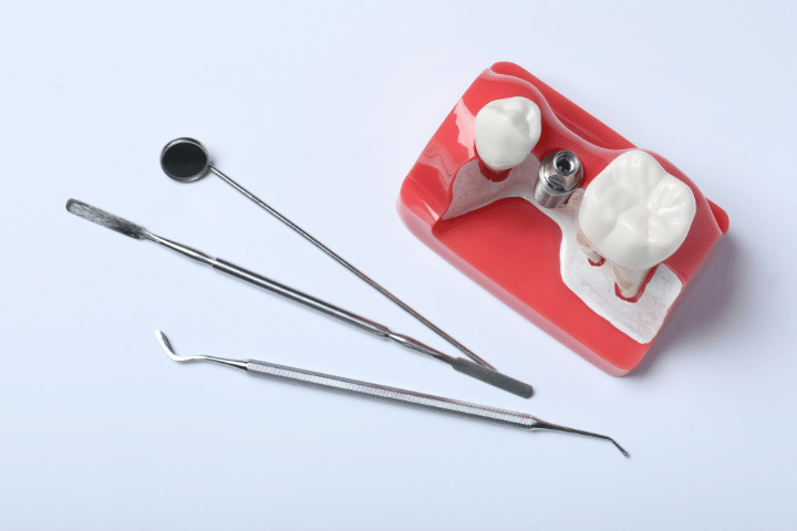 implant crowns