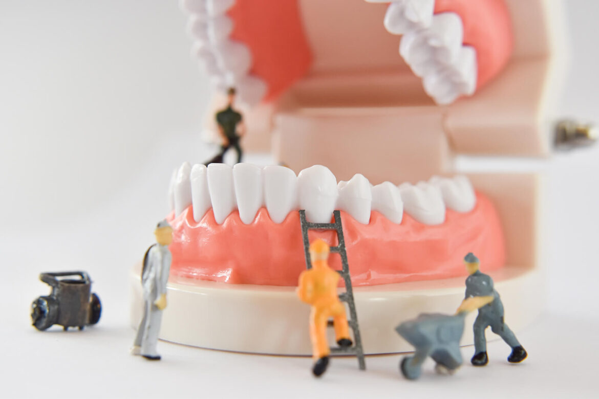 Dental Decay