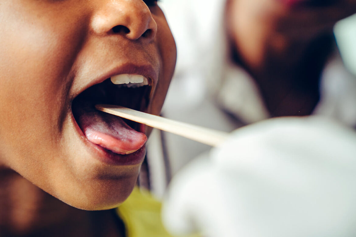 Mouth Gut Connection