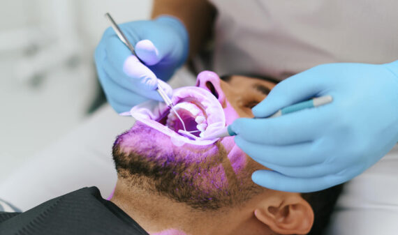 Cosmetic Dentist in Brickell